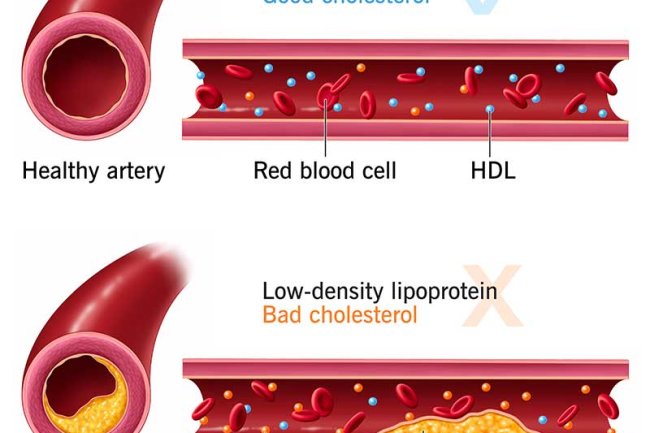 Cholesterol
