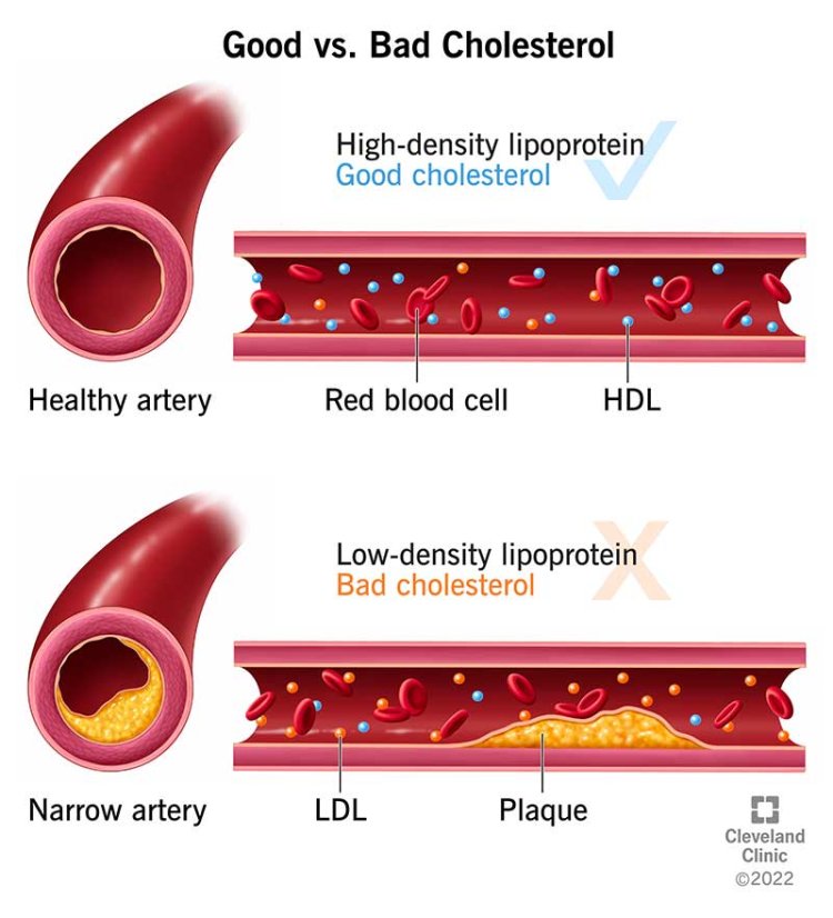 Cholesterol